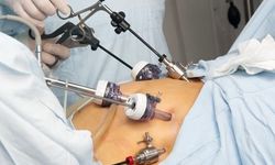 Diyabet Hastaları İçin Çarpıcı Sonuç: Ameliyat mı, Zayıflama İğnesi mi?