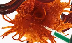 Kanser tedavisinde umut veren yeni yöntem: Tümöre enjekte edilen antikorlar bazı hastalarda tamamen yok etti