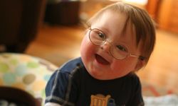 Down Sendromu: Bir Fazlalık Değil, Farklı Bir Ritmin Hikâyesi