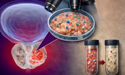 Prostat Tümörlerinde Şok Bulgular: Plastik Parçacıkları Tespit Edildi