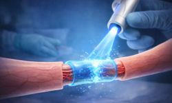 Dikişsiz Sinir Tedavisi Dönemi: Yeni Yöntem FDA’dan Onay Aldı