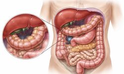 Karında Gaz Sanılıyor, Ama Farklı: Chilaiditi Sendromu Nasıl Anlaşılır, Tedavisi Var mı?