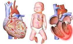 Kawasaki Hastalığı Nasıl Anlaşılır? Çocuklarda Erken Belirti ve Tedavi Uyarısı