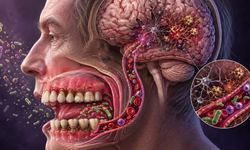 Alzheimer’da Yeni Şüpheli: Diş Eti Bakterileri