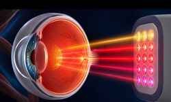 Kırmızı ışık terapisi sarı nokta hastalığında FDA izni aldı