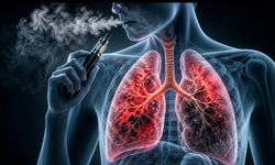 EVALI Nedir, Nasıl Anlaşılır? Elektronik Sigara Akciğeri Sessizce Bitirebilir