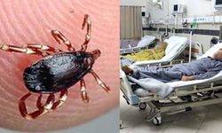 Kene ısırığı sonrası ne yapılmalı, ne yapılmamalı?