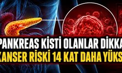 Pankreas Kistlerinde Uzun Takip Uyarısı: Kanser Riski Sanılandan Yüksek Çıktı