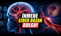 Beyin Damarlarında Ezber Bozan Bulgular: İnmede Tıkanıklık Değil Genişleme Öne Çıktı