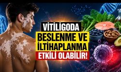 Vitiligoda Yeni Bulgular: Beslenme ve İltihaplanma Hastalığın İlerlemesinde Rol Oynayabilir