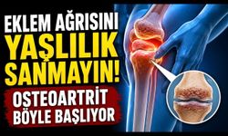 Osteoartrit tedavisi var mı? Eklem ağrısında merak edilenler
