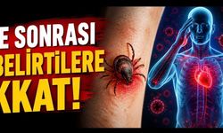Kırım Kongo Kanamalı Ateşi Nasıl Anlaşılır? Belirti, Risk ve Tedavi Süreci