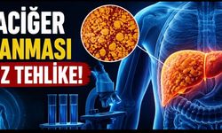 Karaciğer Yağlanmasının Tedavisi Var mı? Uzmanlardan “Geri Döndürülebilir” Uyarısı