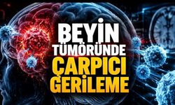 Deneysel CAR-T Tedavisi Beyin Tümöründe Günler İçinde Küçülme Sağladı