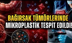 Bağırsak Tümörlerinde Mikroplastik İzleri: Nature Health’ten Dikkat Çeken Çalışma