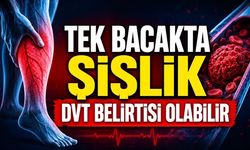 Derin Ven Trombozu nasıl anlaşılır? Bacakta bu belirtilere dikkat