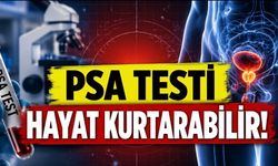 PSA Testi Tartışmasında Yeni Dönem: Prostat Kanseri Ölümlerini Azaltabilir