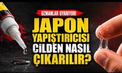 Japon Yapıştırıcısı Cilde Yapışırsa Ne Yapmalı? Uzmanlardan Güvenli Çözüm Önerileri