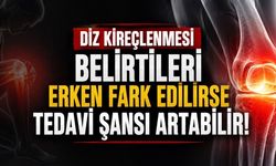 Diz Kireçlenmesi Belirtileri Erken Fark Edilirse Tedavi Şansı Artabilir