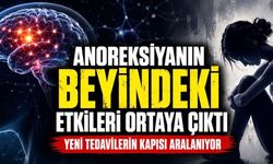Anoreksiyanın Beyindeki Etkisi Yeni Tedavilerin Kapısını Aralayabilir