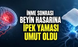 İnme Sonrası Beyin Hasarını Onarım İçin İpek Yama Geliştirildi