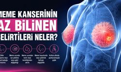 Meme Kanseri Her Zaman Kitleyle Başlamıyor: Uzmanların Dikkat Çektiği 7 Sessiz Belirti