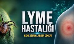 Lyme Hastalığı Nedir? Kene Isırığında Hangi Belirtiler Ciddiye Alınmalı?