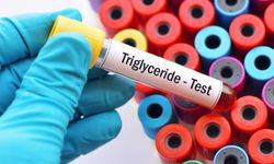 Trigliserit Nasıl Düşürülür? Bilimsel Veriler Etkili Yöntemleri Ortaya Koydu