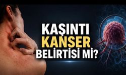 Kaşıntı Kanser Belirtisi Olabilir mi? Uzmanlar Kalıcı Şikayetlerde Dikkat Çağrısı Yaptı