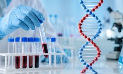 Ferritin Nedir? Ferritin Yüksekliği ve Düşüklüğü Neyi Gösterir?