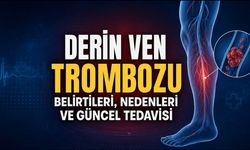 Derin Ven Trombozu Belirtileri, Nedenleri ve Güncel Tedavisi
