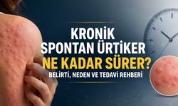 Kronik Spontan Ürtiker Nedir? Belirti, Tedavi ve Yaşam Rehberi