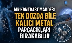MR Kontrast Maddesi Tek Dozda Bile Kalıcı Metal Parçacıkları Bırakabilir