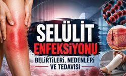 Basit Bir Cilt Sorunu Sanılabiliyor: Selülit Enfeksiyonu Nasıl Anlaşılır?