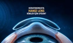 Keratokonus Lensleri: Hangi Lens Kimler İçin Uygun?