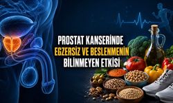 Prostat Kanserinin İlerlemesine Karşı Bilimin Önerdiği 8 Adım