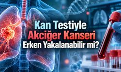Akciğer Kanserini Kan Testiyle Erken Yakalamak Mümkün mü?
