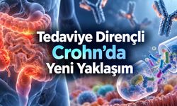 Crohn Hastalığında Gaita Nakli ve Biyolojik Tedavi Birlikte Denendi
