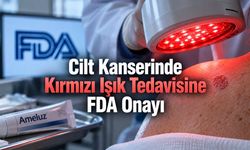 FDA, Yüzeyel Bazal Hücreli Karsinomda Ameluz Fotodinamik Tedavisini Onayladı