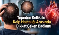 Saçın Nereden Döküldüğü Önemli Olabilir: Kalp Riskiyle Bağlantı Araştırıldı