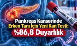 Pankreas Kanserinde Yeni Kan Testi: Erken Evrede Yüzde 86,8 Duyarlılık