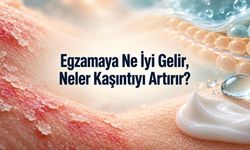Egzamaya Ne İyi Gelir? Kaşıntıyı Azaltan Bakım ve Alevlenmeyi Artırabilen Alışkanlıklar