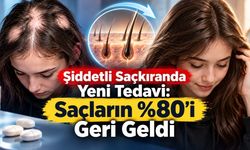 Şiddetli Saçkıranda Yeni FDA Kararı: Ergenlerde Saçların Yüzde 80’i Geri Geldi