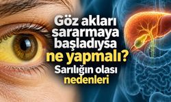 Cilt ve gözler neden sararır? Sarılığın arkasında farklı nedenler olabilir