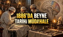 1886'da Beyindeki Hastalıklı Bölge Çıkarıldı: Epilepsi Cerrahisinin Öncü Ameliyatı