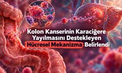 Kolon Kanseri, Yayılmak İçin Bağırsağın Onarım Programını Kullanabiliyor