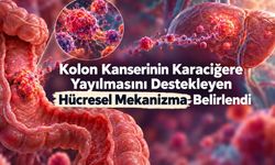 Kolon Kanseri, Yayılmak İçin Bağırsağın Onarım Programını Kullanabiliyor