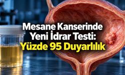 Mesane Kanserinde RNA Temelli İdrar Testi: Tanı ve Tedavi İçin Umut Veren Bulgular