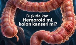Kolon kanseri belirti vermeyebilir: Erken tanıda beklenmemesi gereken işaretler