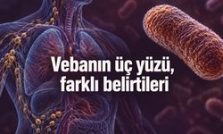 Veba nedir, nasıl bulaşır? Belirtileri ve tedavisi